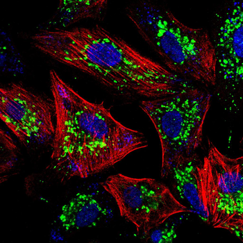 Cytokeratin15 Rabbit Polyclonal Antibody
