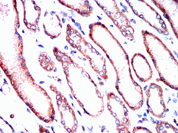 PFKFB3 Antibody