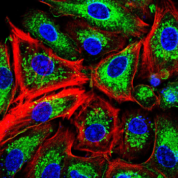 CALD1 Antibody