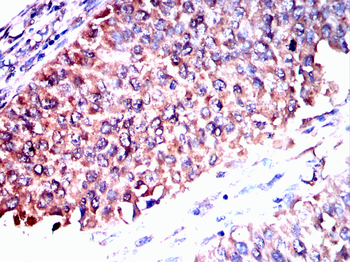 PARK7 Antibody