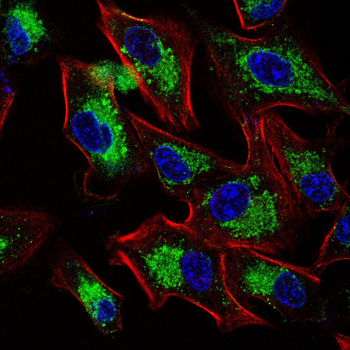 UBA1 Antibody