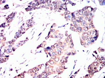 UBA1 Antibody