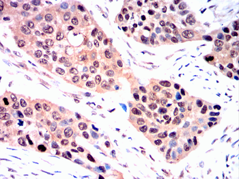 UBA1 Antibody