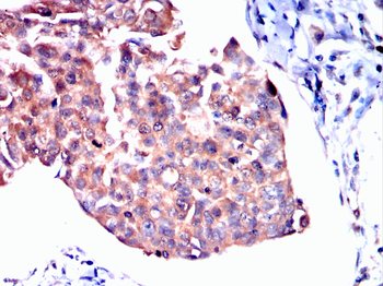 TOP2A Antibody