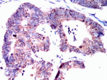 TOP2A Antibody
