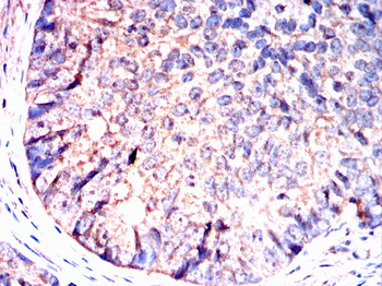 PGK1 Antibody