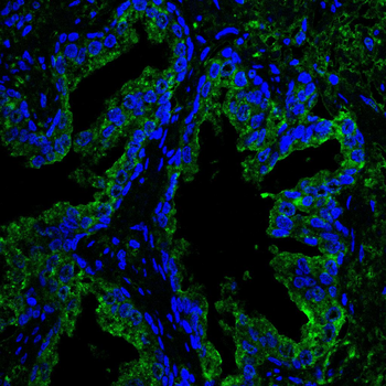 PGK1 Antibody