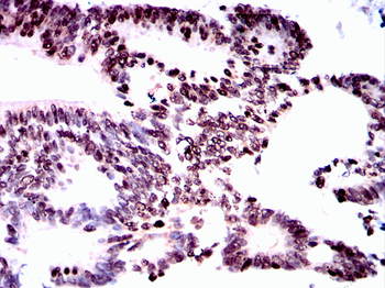 MAPK9 Antibody