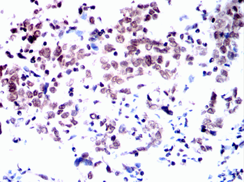 MAPK9 Antibody