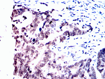 BRAF Antibody