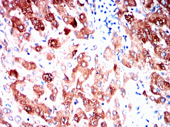 BRAF Antibody