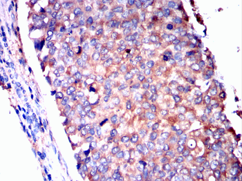 RXRA Antibody