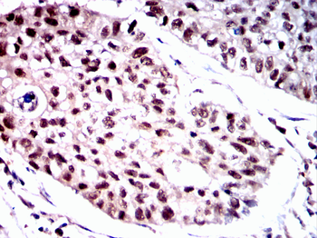 EIF2AK2 Antibody
