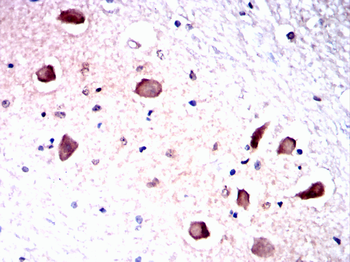 DLG2 Antibody