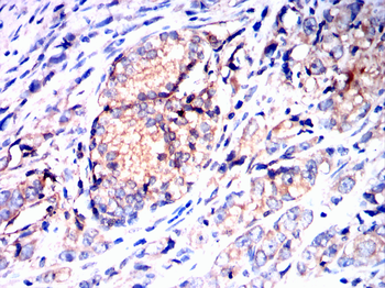 PFKM Antibody