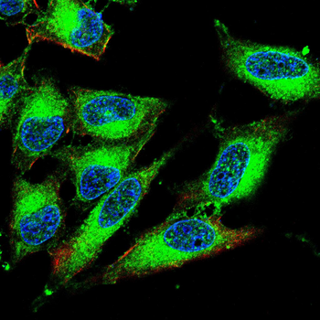 SGCG Antibody