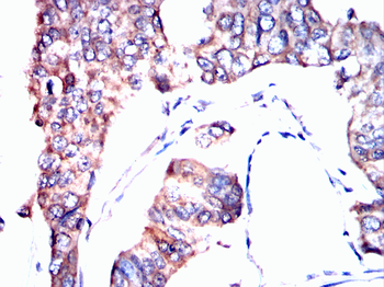 SGCG Antibody