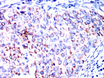 SGCG Antibody