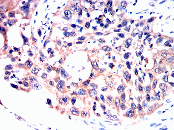 SGCG Antibody