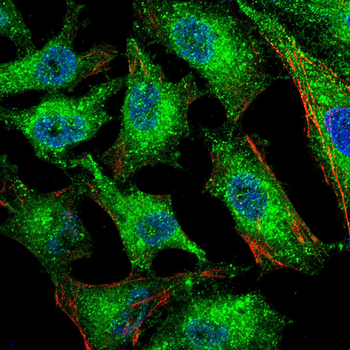 FTH1 Antibody