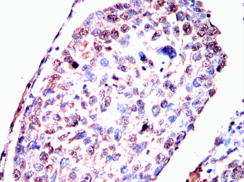 FTH1 Antibody
