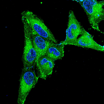 HP Antibody
