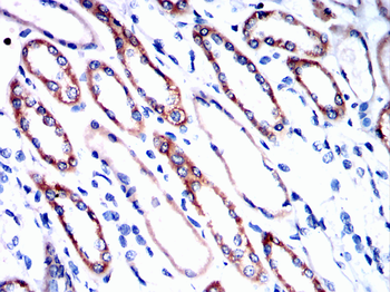 HP Antibody