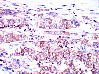 HP Antibody