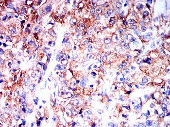 GCLM Antibody