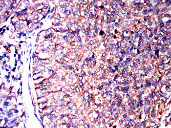 ADK Antibody