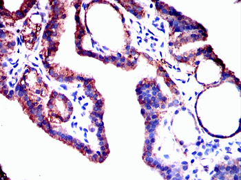 ADK Antibody
