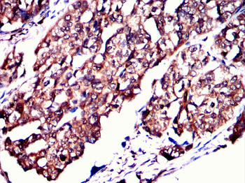 ACHE Antibody
