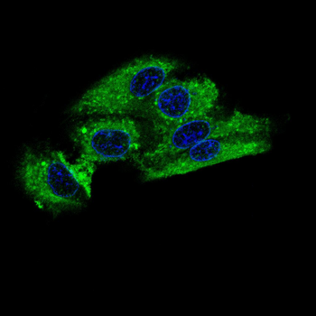 PFKP Antibody