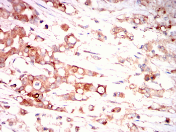 PFKP Antibody