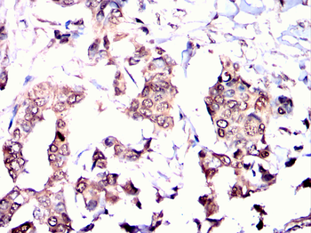 RAD23B Antibody