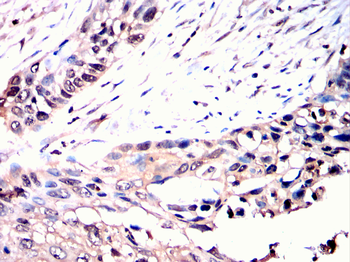 RAD23B Antibody
