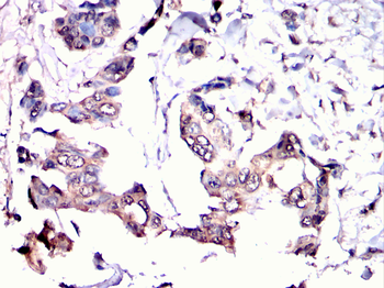 ATG4D Antibody