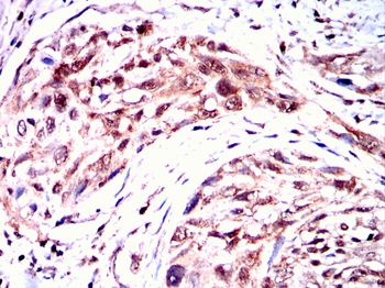 RPS6KB2 Antibody