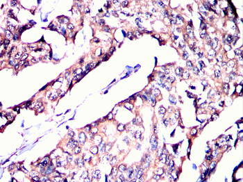 TGM2 Antibody