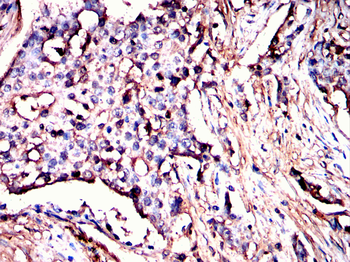 TGM2 Antibody