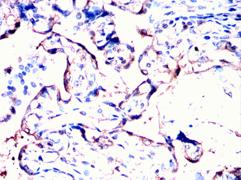GDF15 Antibody