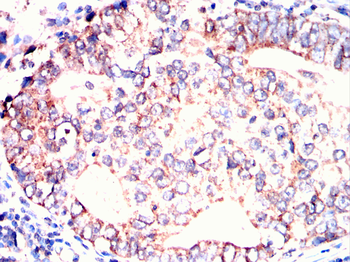 SERPINB3 Antibody
