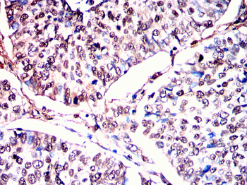 IKBKG Antibody
