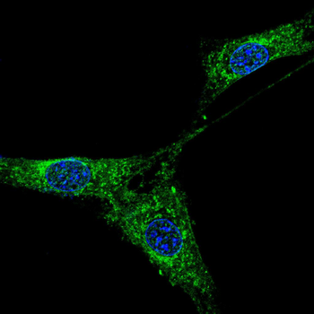 APCS Antibody