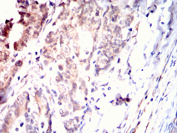 LGALS3 Antibody