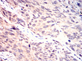 CNOT4 Rabbit Polyclonal Antibody