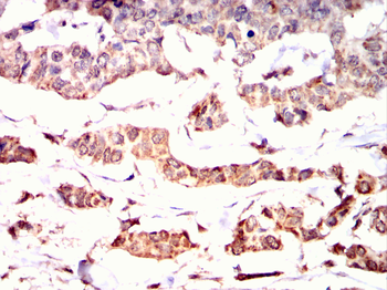 LIMK1 Antibody