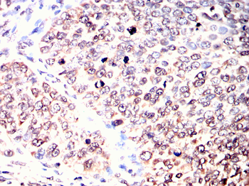 YEATS4 Rabbit Polyclonal Antibody