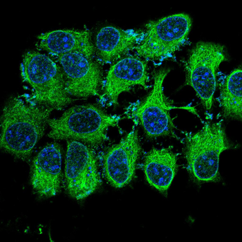 TPX2 Antibody