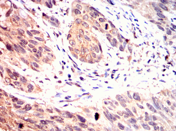 TPX2 Antibody